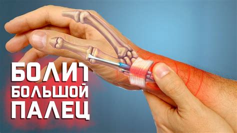 Причины и лечение боли в лучевом суставе на руке
